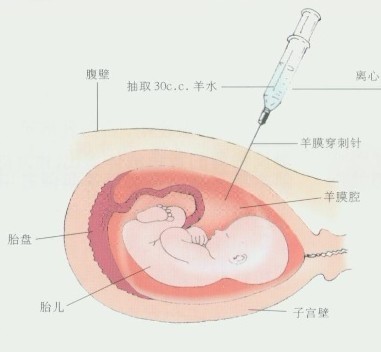 怀孕去哪里有亲子鉴定（怀孕八周，哪里可以做胎儿亲子鉴定）